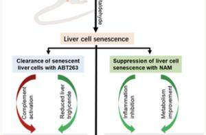 精准抑制细胞衰老可有效缓解酒精性肝病