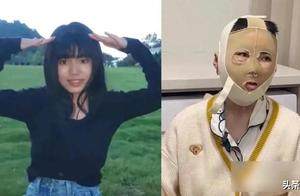 女子被泼汽油烧伤，赔偿金压垮两家，二审未决谁来还钱？