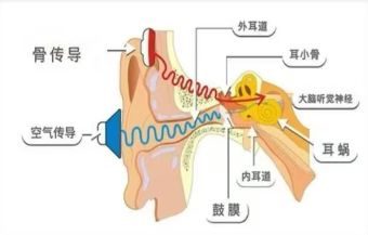 开放式耳机是什么？哪个品牌好？开放式蓝牙耳机推荐2025