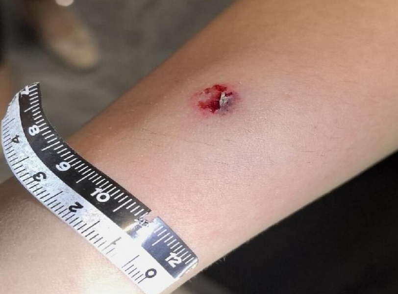司机心理健康问题需重视：货车司机向路人射钢珠致使4名女性受伤