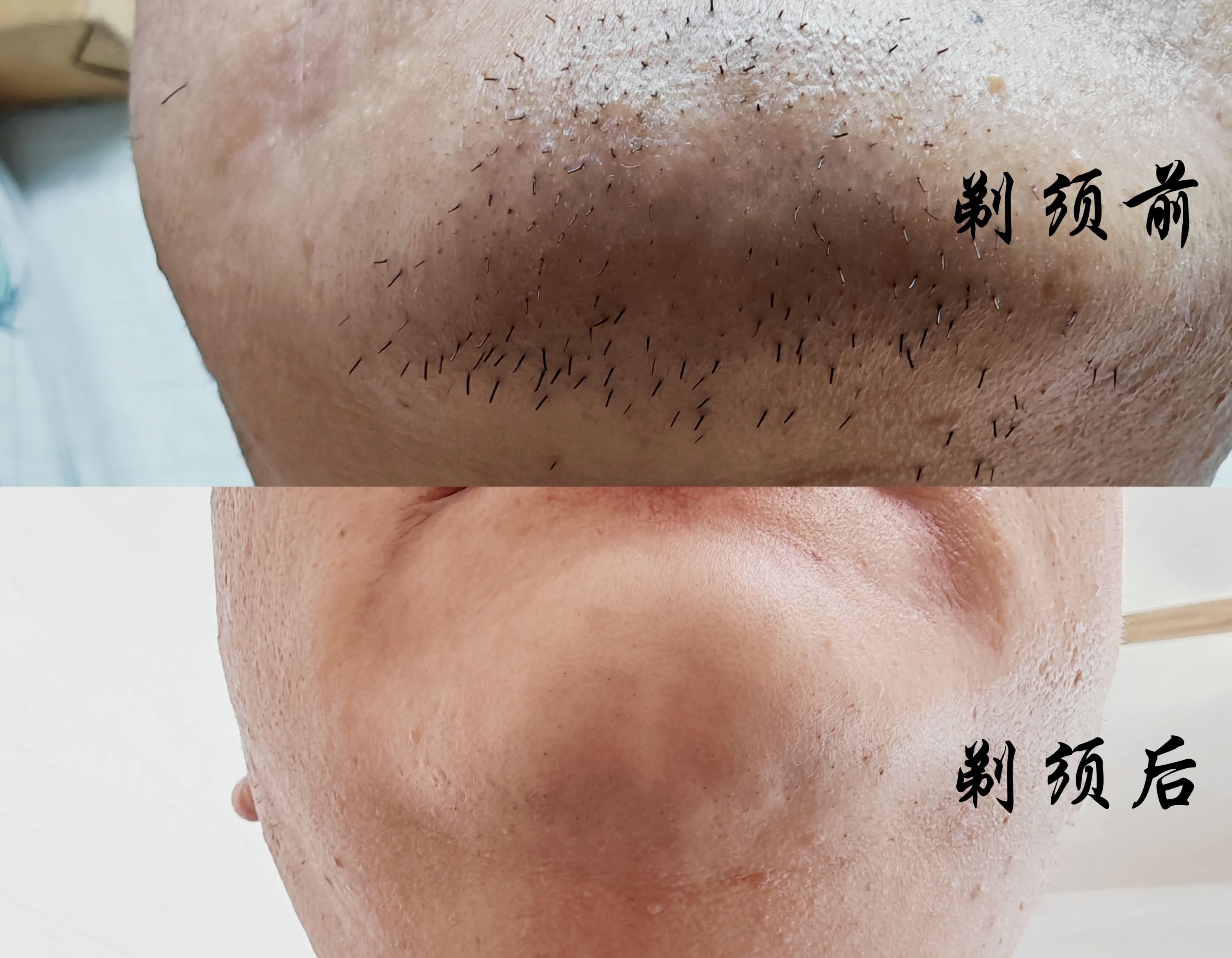 未野往复式剃须刀实测：23000高转速暴力输出，首款迷你五刀头直追千元级