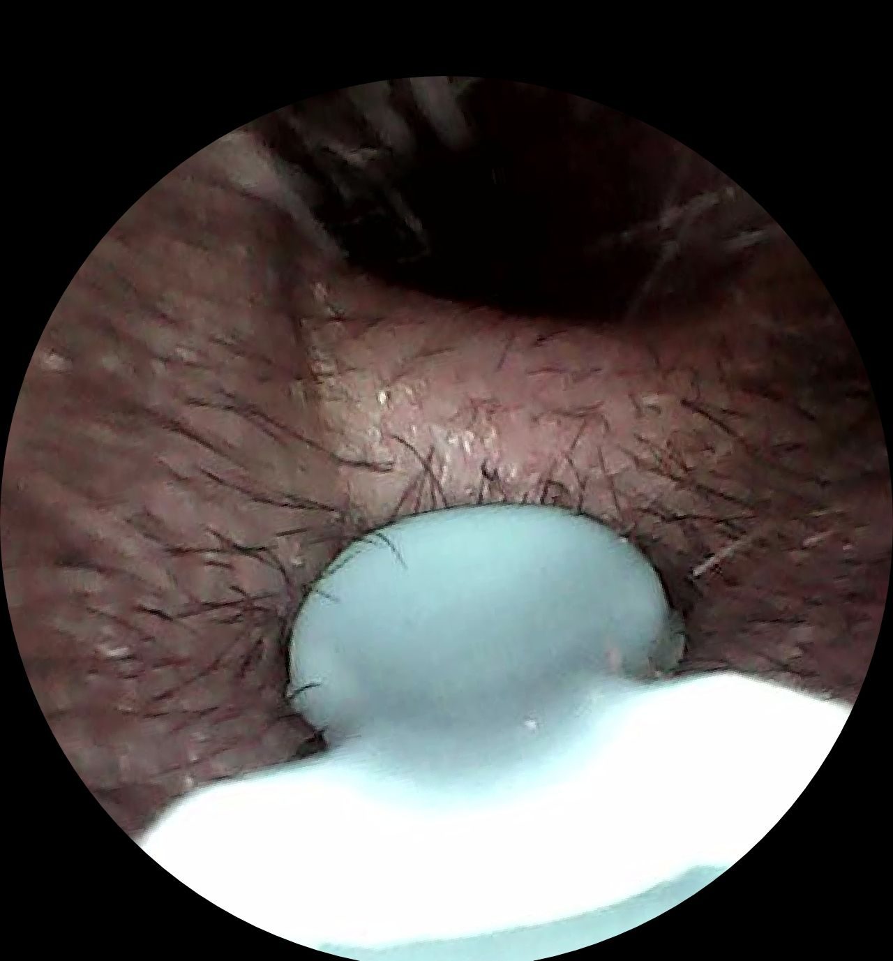 挖耳的科技感，安全还可视化，西圣Find X可视挖耳勺使用体验来了